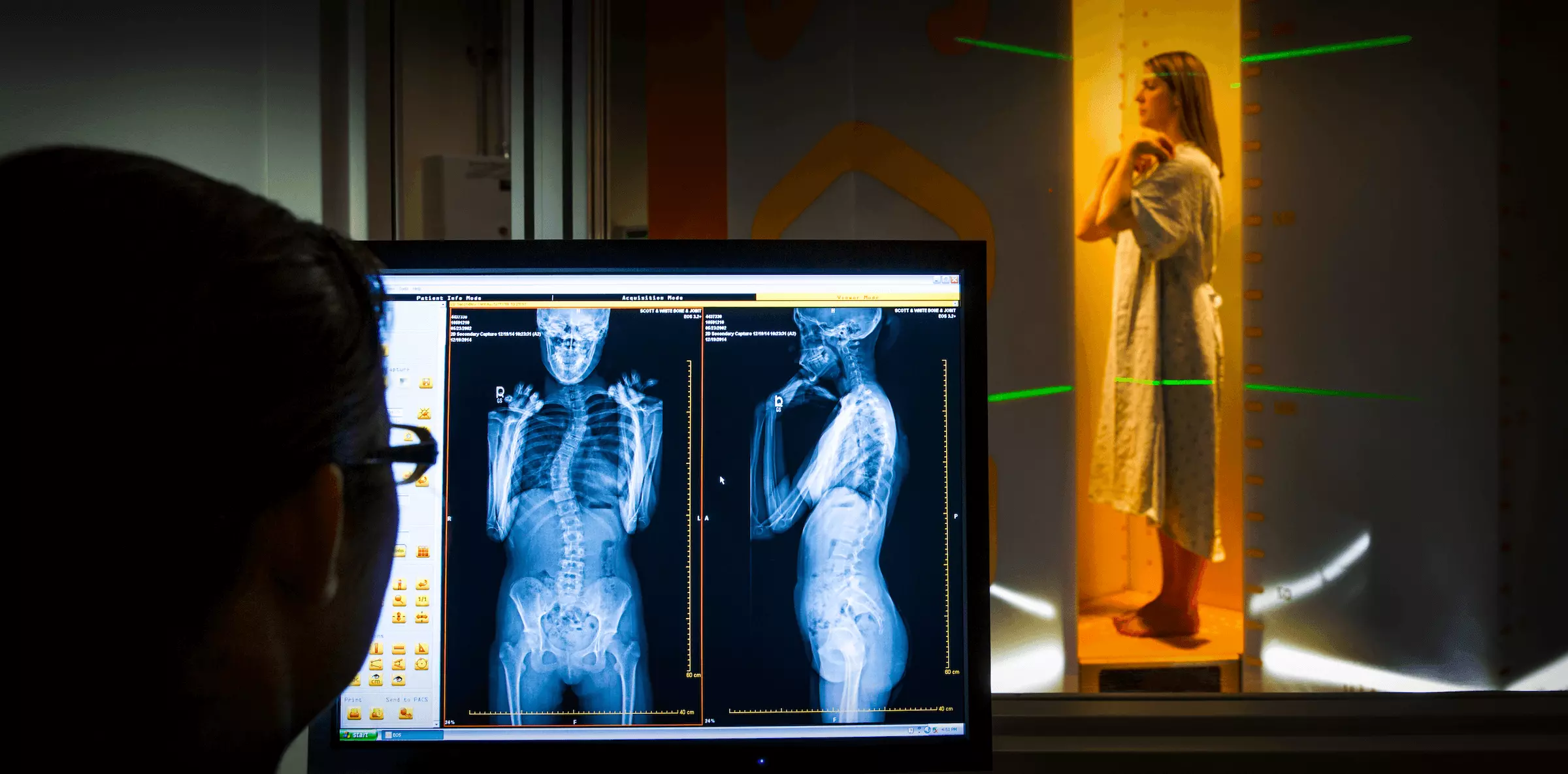 Doctor checking on chest X-ray. Man holding radiography looking at