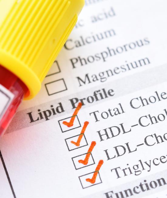 Lipid profile