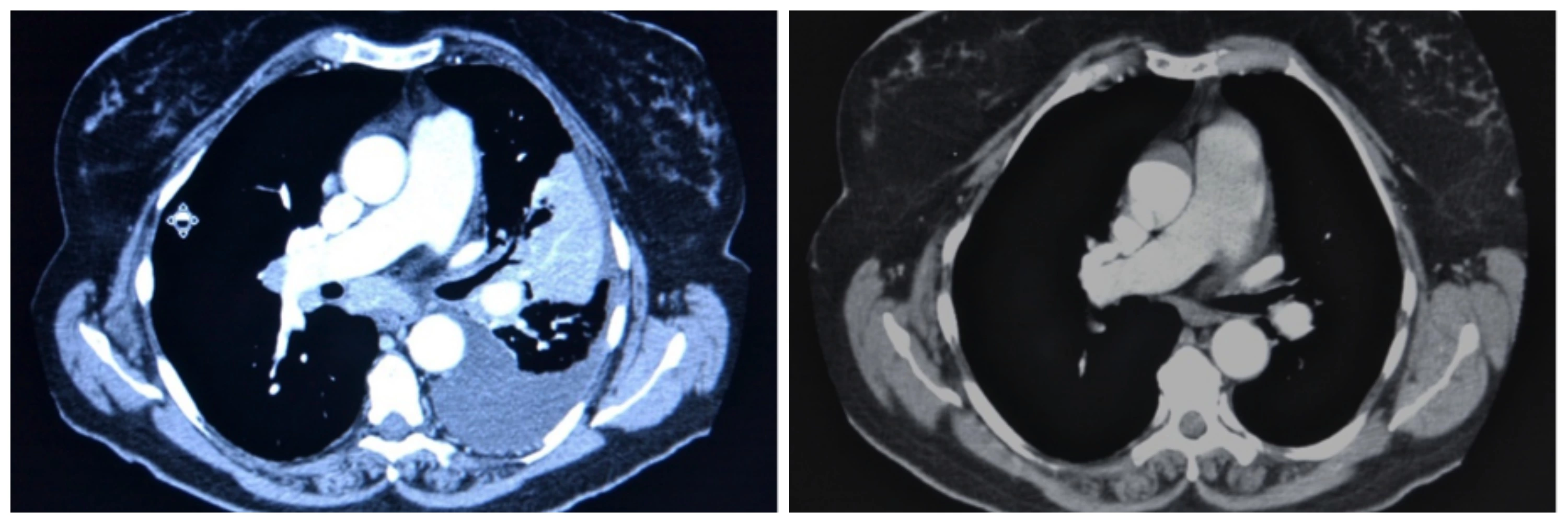 precision medicine x-rays