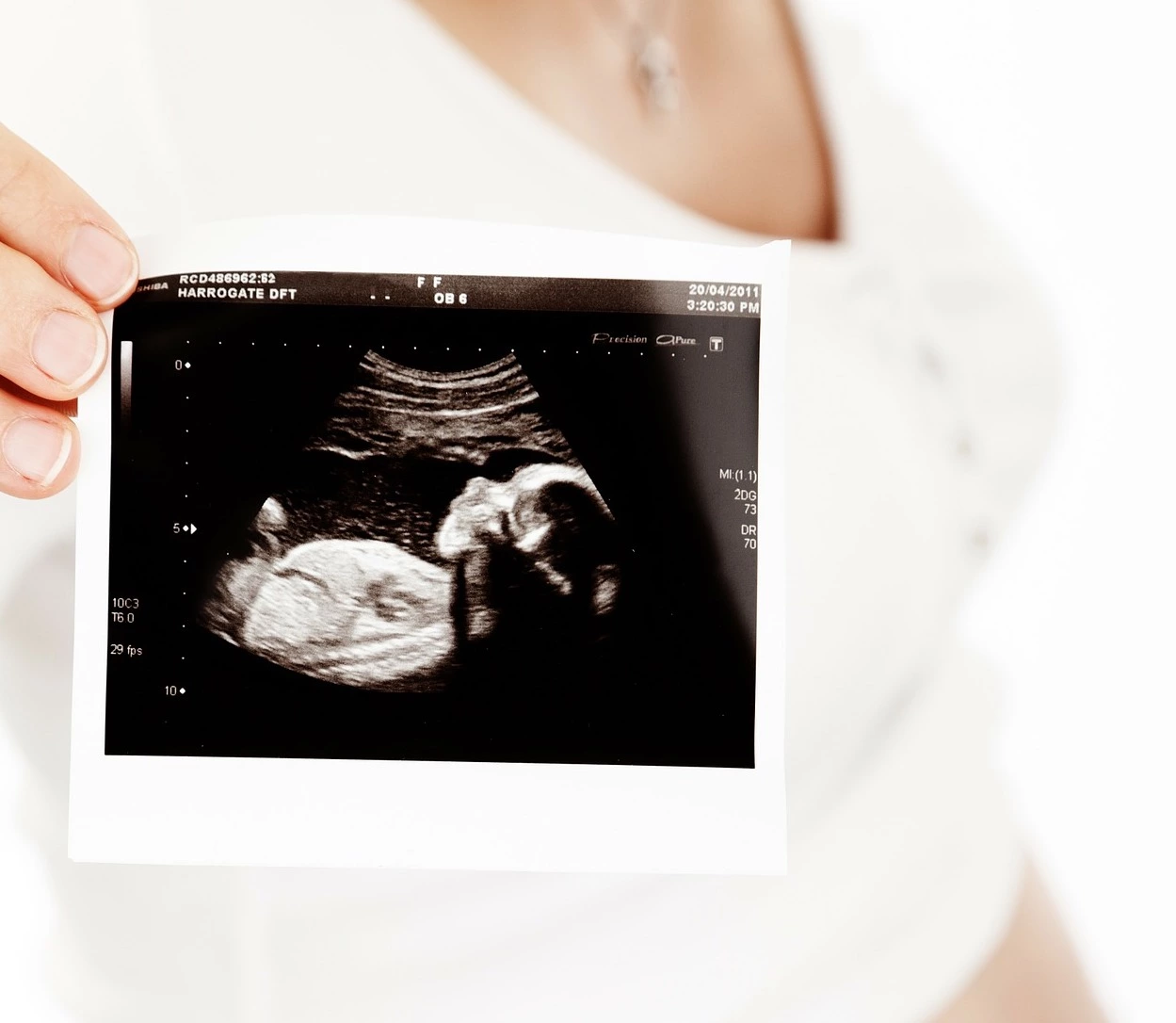 What ultrasounds can tell you about the health of your baby