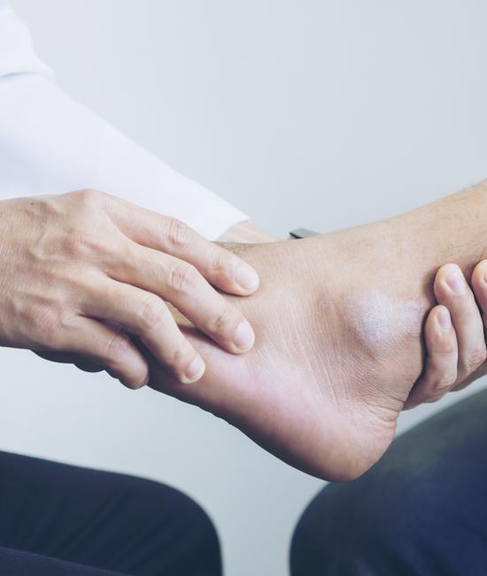 Ankle Sprains  Summit Orthopedics